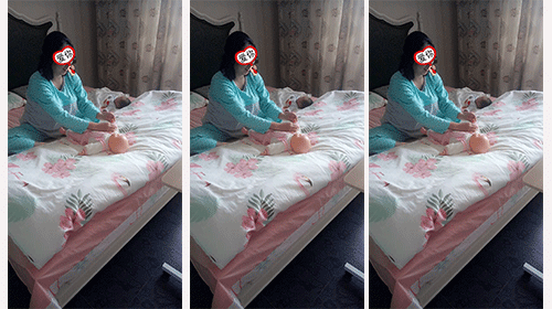 剖腹产疤痕如何护理?避免这些常见误区